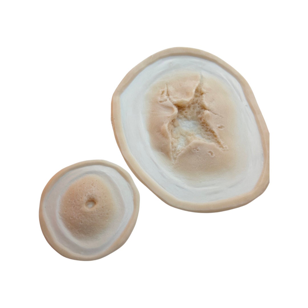 gunshot wound Set - Entry & Exit