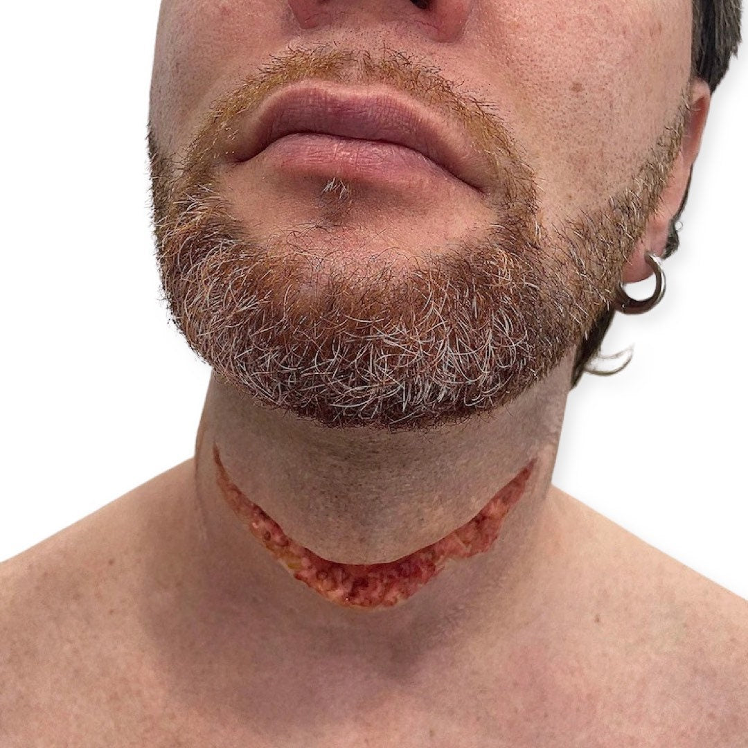 Large slit throat