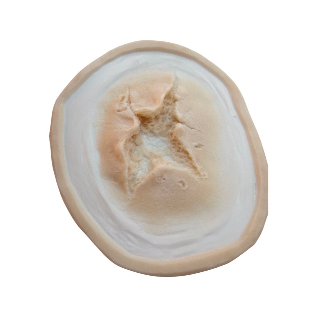 gunshot wound Set - Entry & Exit