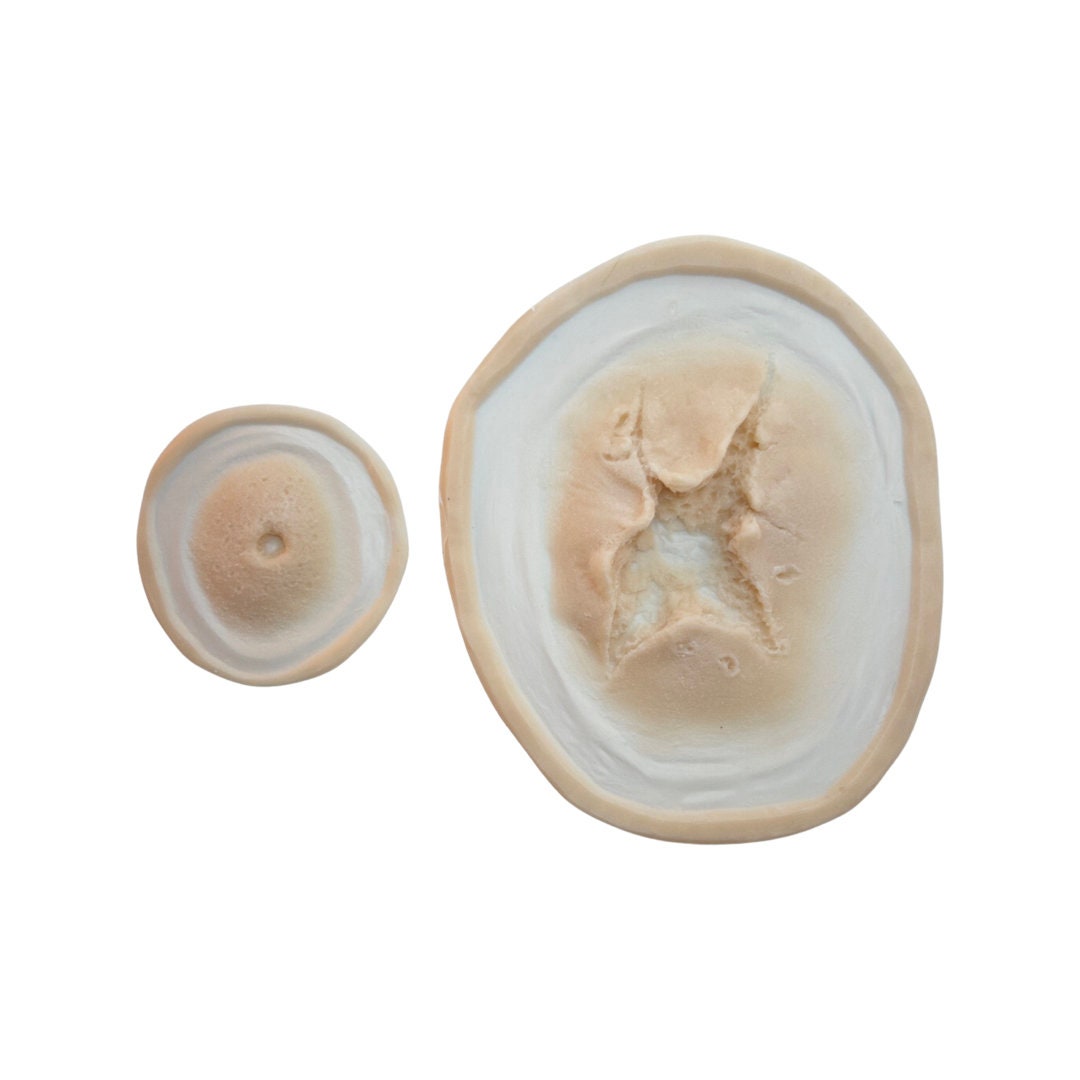 gunshot wound Set - Entry & Exit