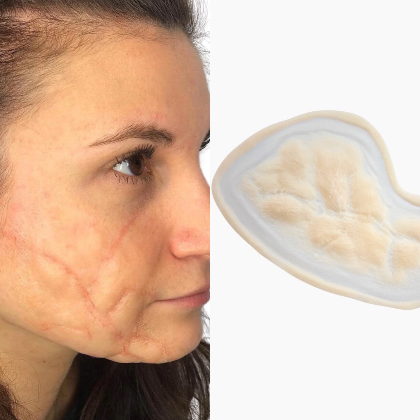 Deformed scar