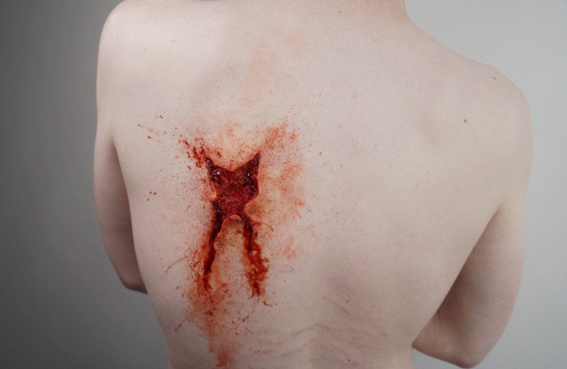 gunshot wound Set - Entry & Exit