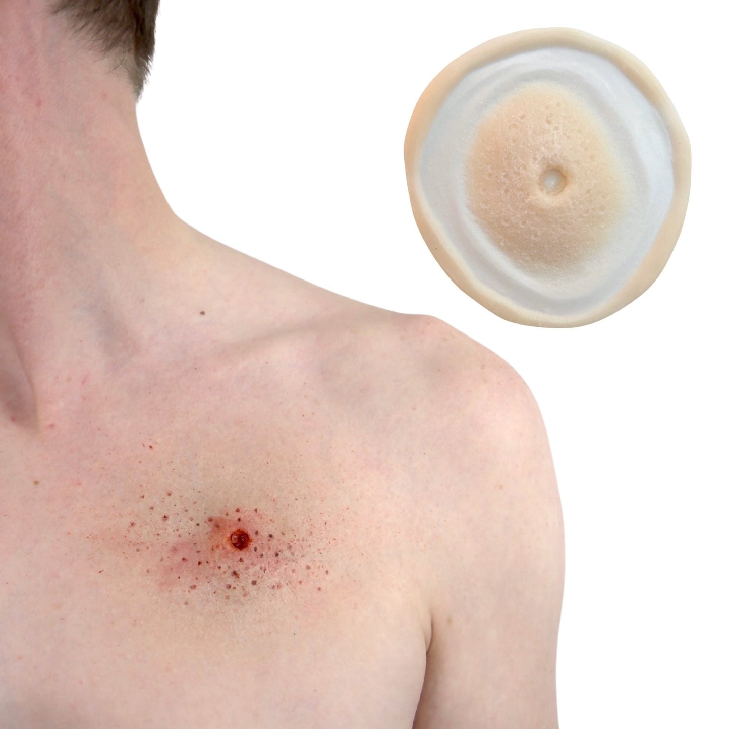 gunshot wound Set - Entry & Exit