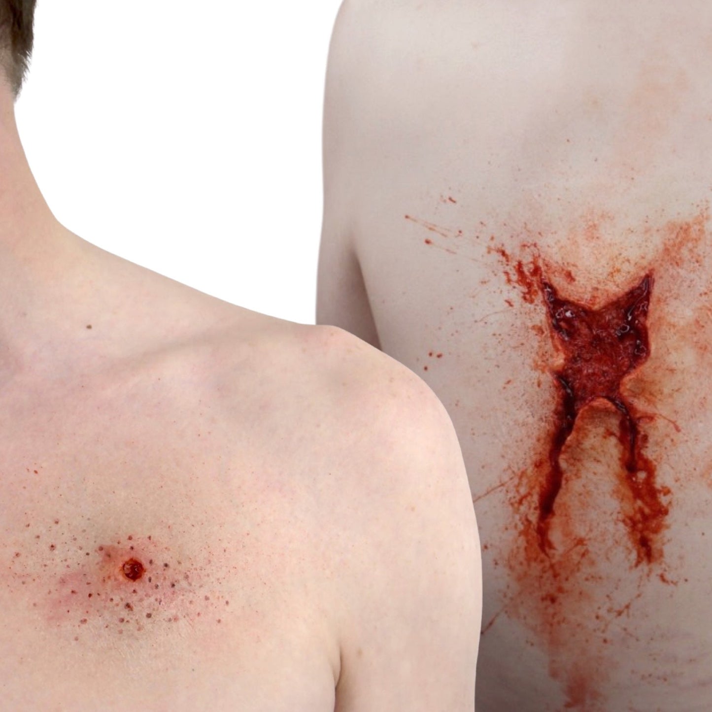 gunshot wound Set - Entry & Exit