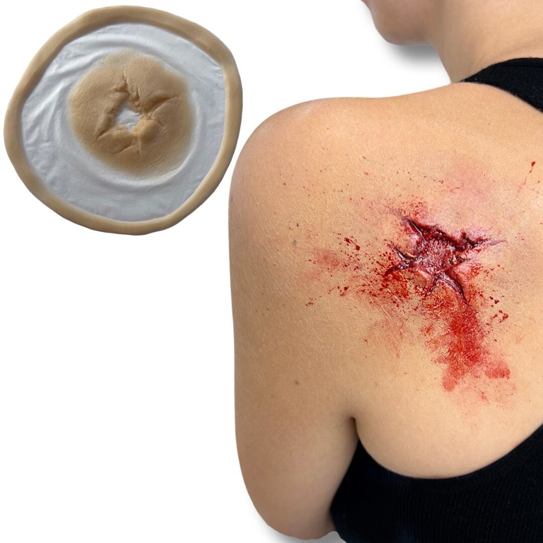 Shotgun Entry Wound