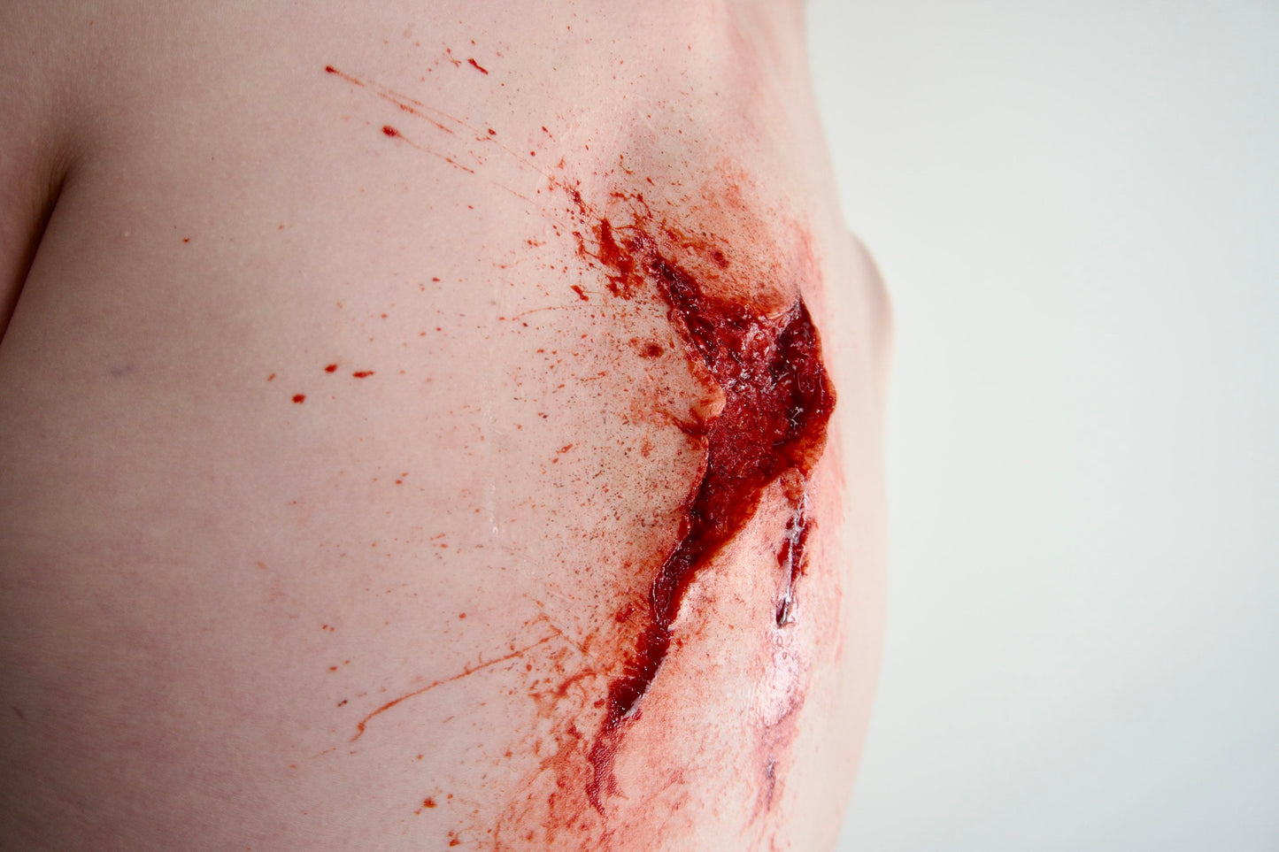 gunshot wound - entrance gun - exit shotgun wound - bullet hole